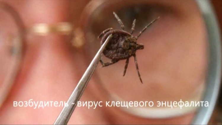 За лето от укусов клещей пострадали более 6 тысяч жителей Ленобласти